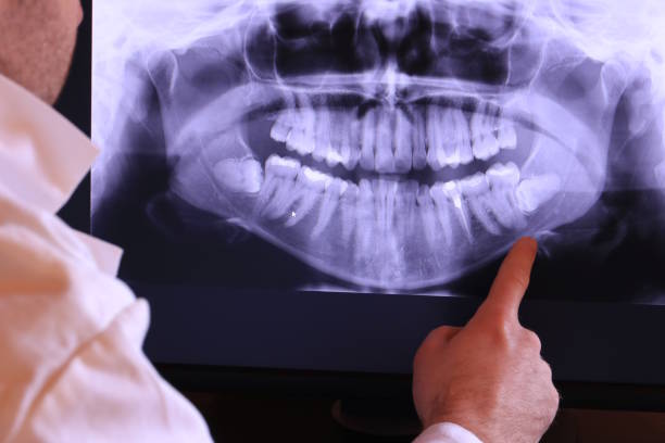 Best Dental Abscess Treatment in Shell Point, SC